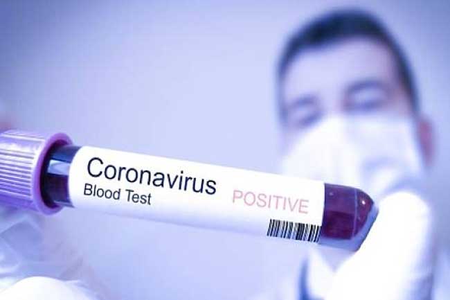 Ilustrasi Blood Test Coronavirus.(Sumber: Gatra.com)